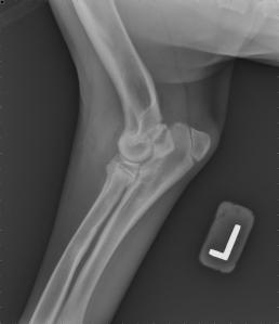 Patient with an ununited coronoid process. 