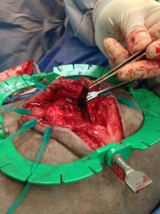 Here is the stick as it is lodged under the rib.