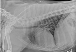 Plain chest radiograph (x-ray)