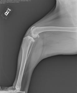 Right knee - note the joint swelling, arthritic changes, and forward movement of the tibia in relation to the femur. 