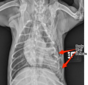 Note the multiple rib fractures and the multiple thoracic wall defects.
