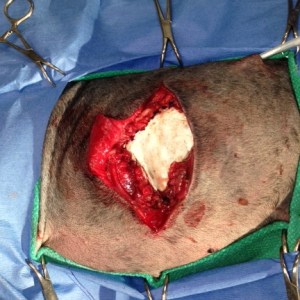 This is demonstrating the placement of the Vetrix ECM sheet for repair of the thoracic wall. 