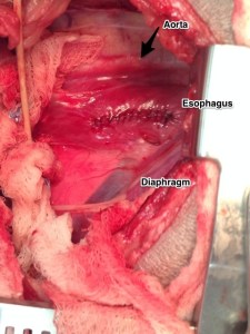 View of the esophagus just past the heart.