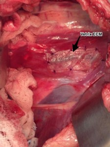 Vetrix Extracellular Matrix placement over the esophageal incision. 