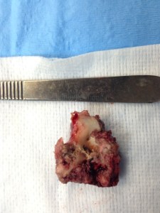 This was the piece of rawhide that was lodged in Tido's esophagus. It was nearly 5cm in length!!