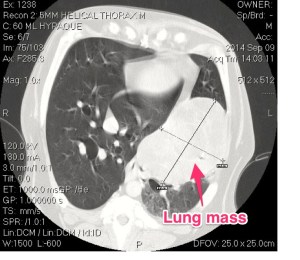 CT scan of the chest showing the lung tumor (see arrow)