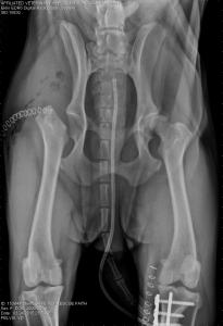 Right femoral head ostectomy