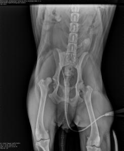 Right hip luxation