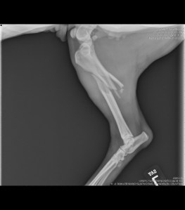 Left tibia/fibula fracture